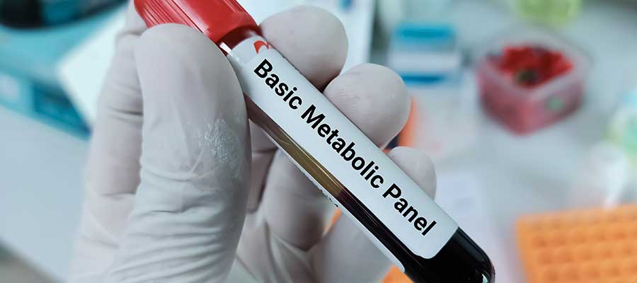 Basic Metabolic Panel (BMP) Blood Test Clinic Near me in Kansas City, MO