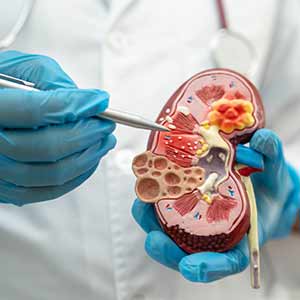 Chronic Kidney Disease Clinic in Kansas City, MO