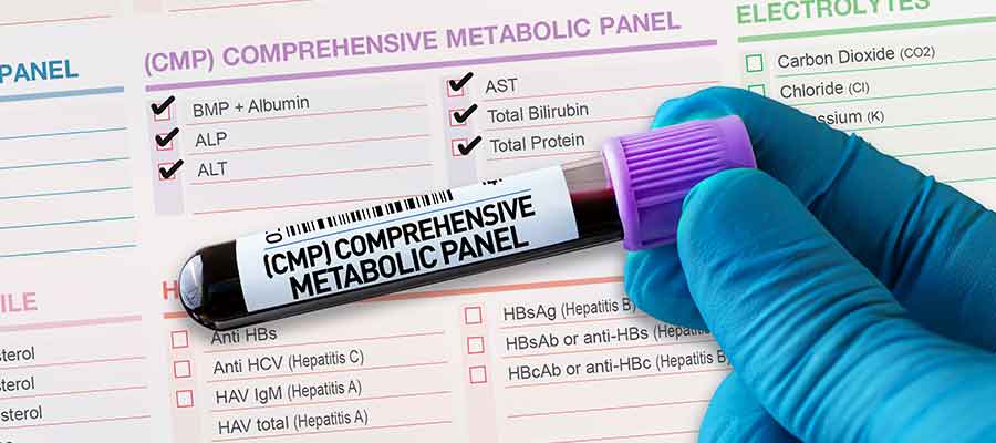 Comprehensive Metabolic Panel (CMP) Blood Test in Kansas City, MO Comprehensive Metabolic Panel (CMP) Blood Test in Kansas City, MO