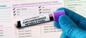 Comprehensive Metabolic Panel (CMP) Blood Test in Kansas City, MO Comprehensive Metabolic Panel (CMP) Blood Test in Kansas City, MO