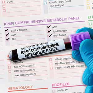 Comprehensive Metabolic Panel (CMP) in Kansas City, MO