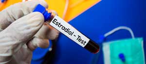 Estradiol Test Near Me in Kansas City, MO