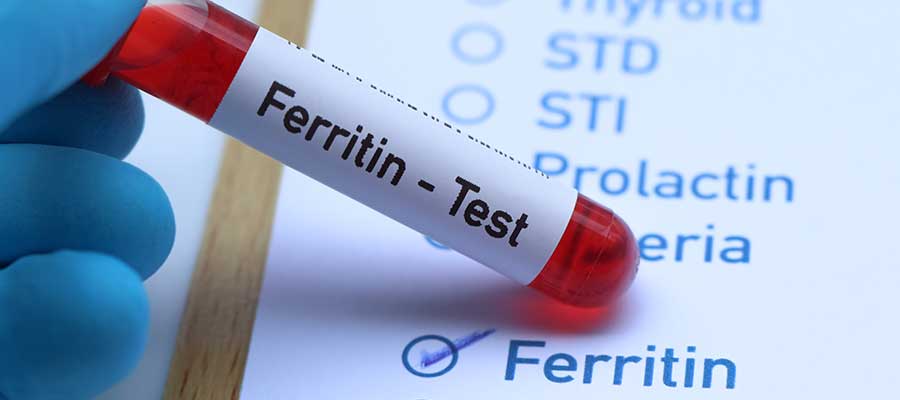 Ferritin Test Near Me in Kansas City, MO Ferritin Test Near Me in Kansas City, MO