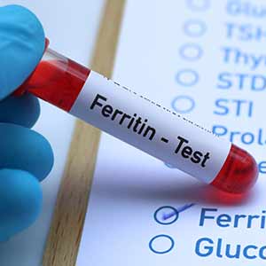 Ferritin Test in Kansas City, MO