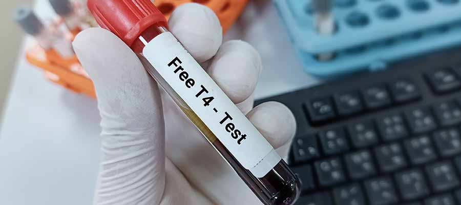 Free T4 (Thyroxine) Test Near Me in Kansas City, MO Free T4 (Thyroxine) Test Near Me in Kansas City, MO