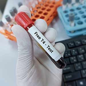 Free T4 (Thyroxine) Test in Kansas City, MO