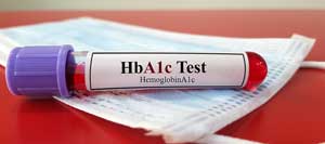 Hemoglobin A1C Test Near Me in Kansas City, MO Hemoglobin A1C Test Near Me in Kansas City, MO