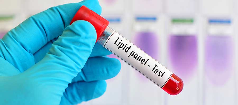Lipid Panel Test Near Me in Kansas City, MO Lipid Panel Test Near Me in Kansas City, MO