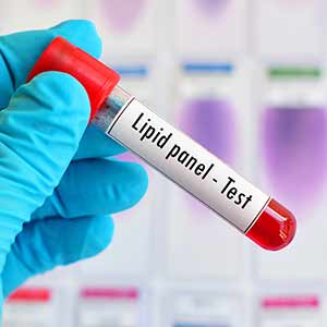 Lipid Panel Near Me in Kansas City, MO