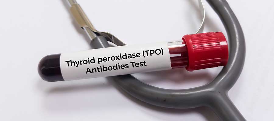 Thyroid Peroxidase Antibodies (TPO) Testing Clinic Near Me in Kansas City, MO Thyroid Peroxidase Antibodies (TPO) Testing Clinic Near Me in Kansas City, MO