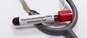 Thyroid Peroxidase Antibodies (TPO) Testing Clinic Near Me in Kansas City, MO Thyroid Peroxidase Antibodies (TPO) Testing Clinic Near Me in Kansas City, MO
