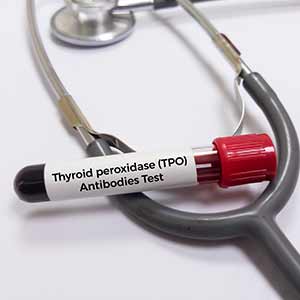 Thyroid Peroxidase Antibodies (TPO) in Kansas City, MO